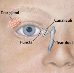 Blocked Tear Ducts in Children